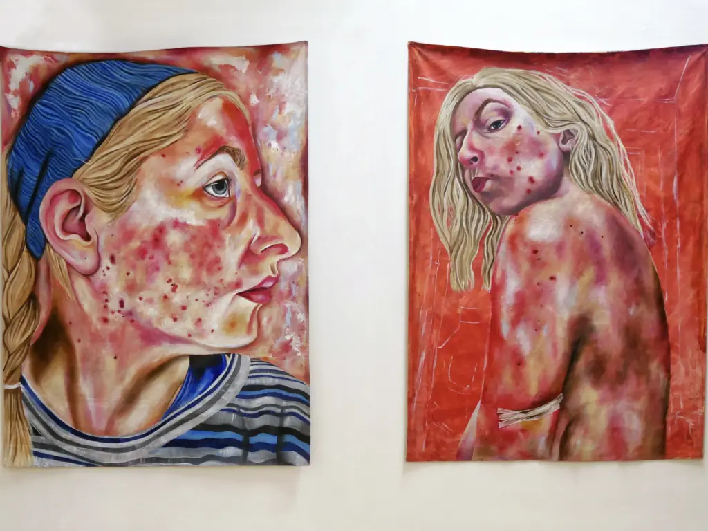 Chloe Edwards - BA(Hons) Fine Art